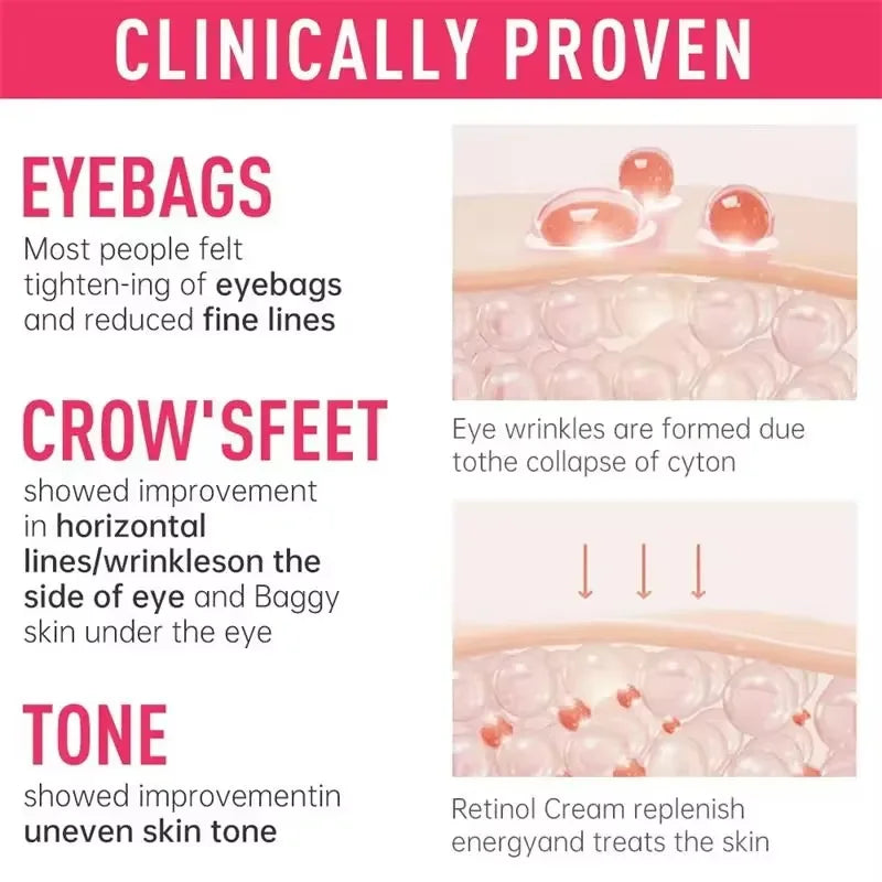 Retinol Eye Cream