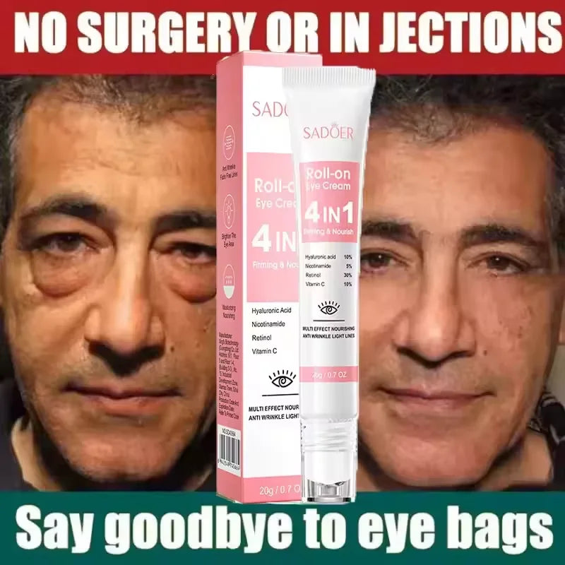 Retinol Eye Cream